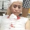 Joven recibe fracturas tras  riña en Drink de Las Lagunas de Nisibón