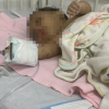 Mujer golpea su bebé de un mes hasta causarle fracturas de cráneo y romperle dos costillas en Miches