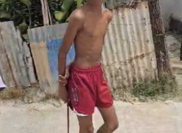Agreden y amenazan a contratistas de Edeeste que normalizaban servicio en comunidad de Higüey