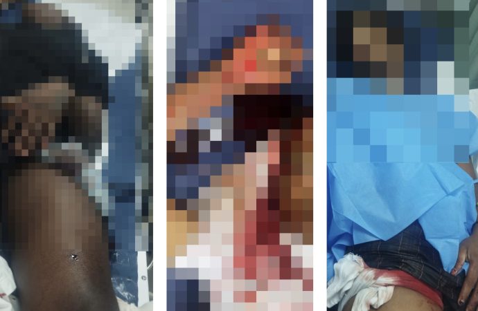 Muere uno de tres jóvenes heridos de bala en el sector Antonio Guzmán, Higüey