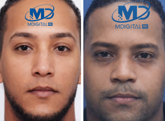 Sobrevivientes de accidente entre autobús de APTPRA y camión permanecen estables