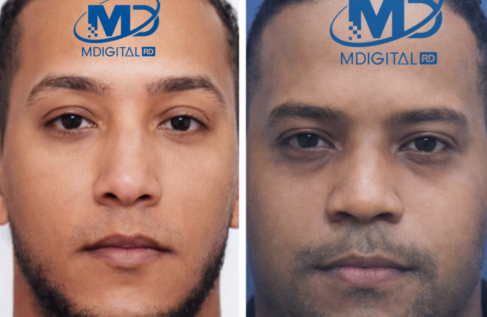 Sobrevivientes de accidente entre autobús de APTPRA y camión permanecen estables