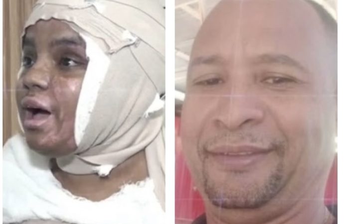 Condena de 30 años a hombre que quemó con  aceite hirviendo  a su expareja en Veron
