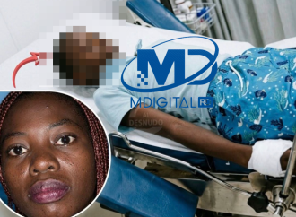 Madre provoca quemaduras de segundo grado a su hijo de 10 años en Higüey