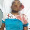 Muere hombre tras sufrir descarga eléctrica y caer de poste en Higüey
