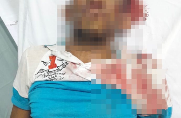 Muere hombre tras sufrir descarga eléctrica y caer de poste en Higüey