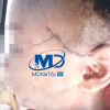 Hombre hiere menor de nueve años en Sabana,Nisibón
