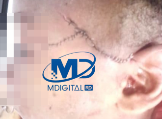 Hombre hiere menor de nueve años en Sabana,Nisibón
