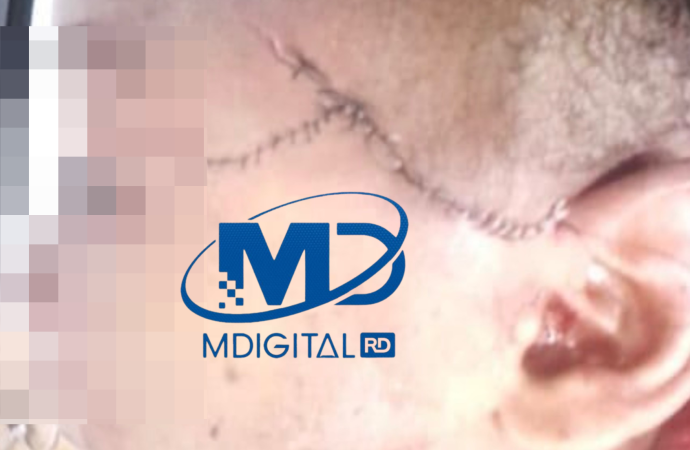 Hombre hiere menor de nueve años en Sabana,Nisibón