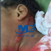 Niña de siete años resulta herida en el cuello durante riña en San Pedro de Macorís