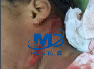 Niña de siete años resulta herida en el cuello durante riña en San Pedro de Macorís