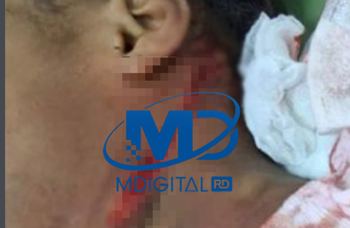 Niña de siete años resulta herida en el cuello durante riña en San Pedro de Macorís