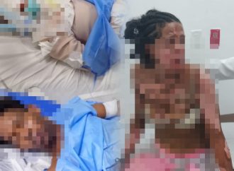 Mujer y su pareja resultan con quemaduras tras incendio de vivienda en Higüey