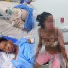 Mujer y su pareja resultan con quemaduras tras incendio de vivienda en Higüey