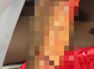 Hombre resulta herido tras intento de atraco en Villa Cerro