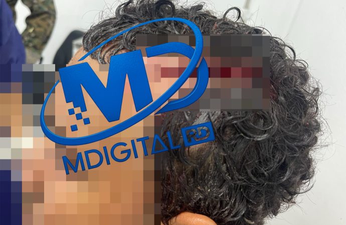 Hombre resulta herido durante riña con compañero de trabajo en Higüey