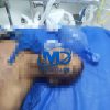 Hombre muere tras presunto enfrentamiento policial en Higüey